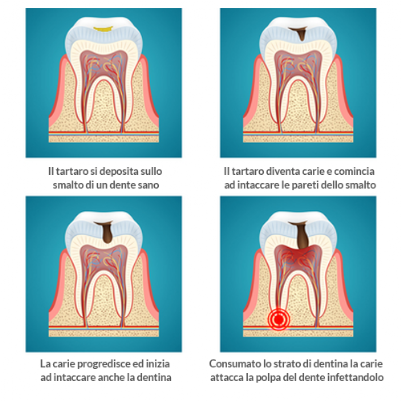 Endodonzia Endodonzia
