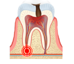 Endodonzia